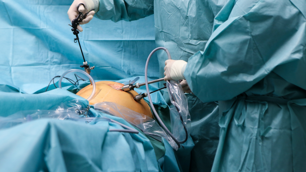 Sektion Darm-Chirurgie / Kolorektlchirurgie | Krankenhaus Reinbek